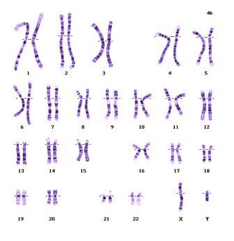Normální obraz karyotypu
